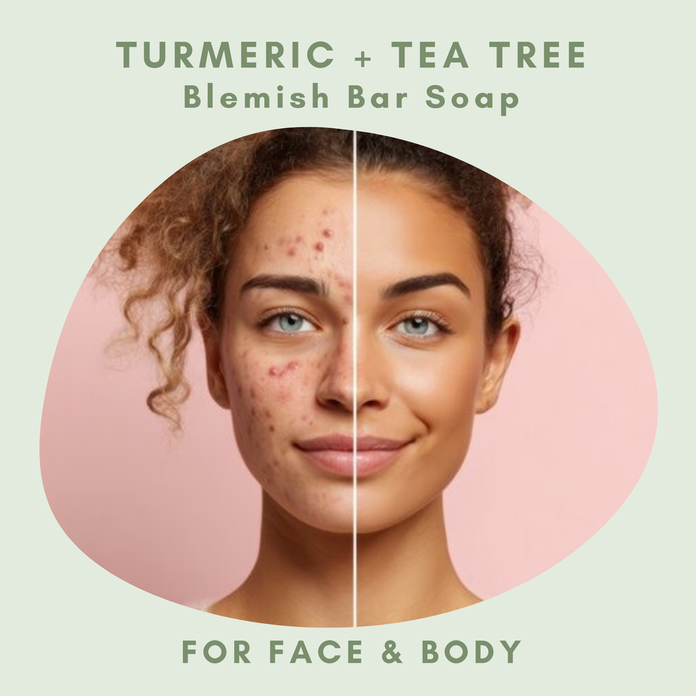Turmeric + Tea Tree Blemish Bar secondary